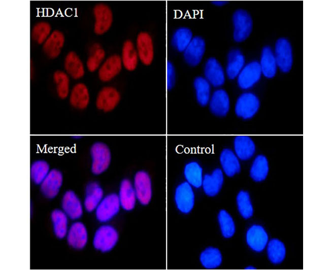 HDAC1 Rabbit mAb(HDAC1兔单抗)(AG8018)