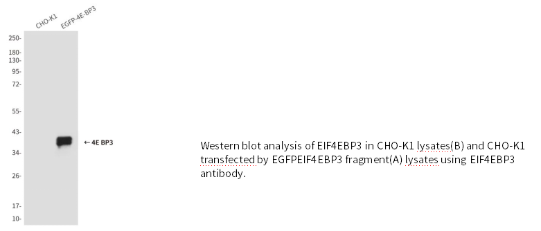 4E BP3小鼠单克隆抗体 4E BP3 Mouse mAb(小鼠单抗)