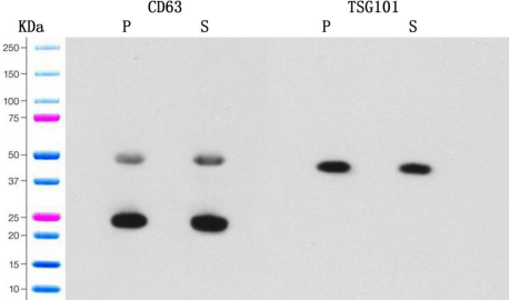 WB外泌体鉴定试剂盒|Exosome identification Kit for Western Blot