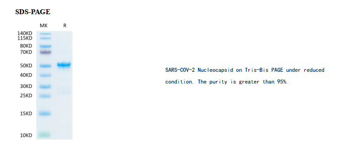 Recombinant SARS-COV-2 Nucleocapsid Protein,His-Avi Tag