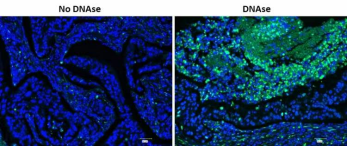 Annexin V-FITC/PI细胞凋亡检测试剂盒|Annexin V-FITC/PI Apoptosis Detection Kit